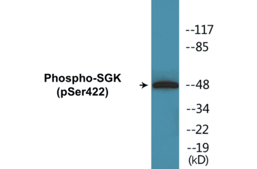 Western Blot - SGK (phospho Ser422) Cell Based ELISA Kit (CBP1080) - Antibodies.com