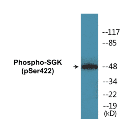 Western Blot - SGK (phospho Ser422) Cell Based ELISA Kit (CBP1080) - Antibodies.com