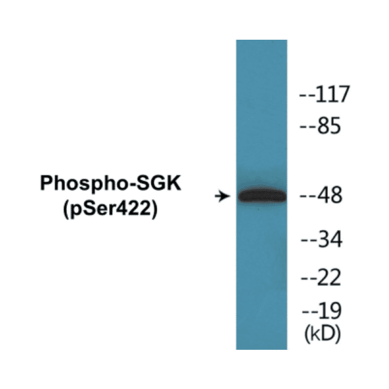Western Blot - SGK (phospho Ser422) Cell Based ELISA Kit (CBP1080) - Antibodies.com