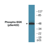 Western Blot - SGK (phospho Ser422) Cell Based ELISA Kit (CBP1080) - Antibodies.com
