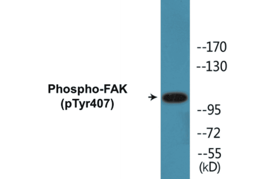 Western Blot - FAK (phospho Tyr407) Cell Based ELISA Kit (CBP1154) - Antibodies.com