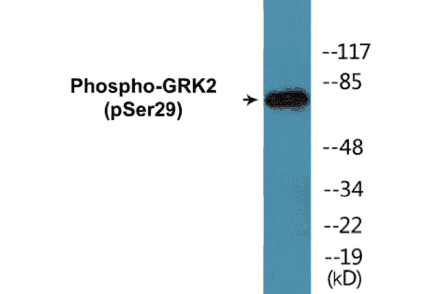 Western Blot - GRK2 (phospho Ser29) Cell Based ELISA Kit (CBP1161) - Antibodies.com