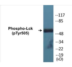 Western Blot - Lck (phospho Tyr505) Cell Based ELISA Kit (CBP1174) - Antibodies.com