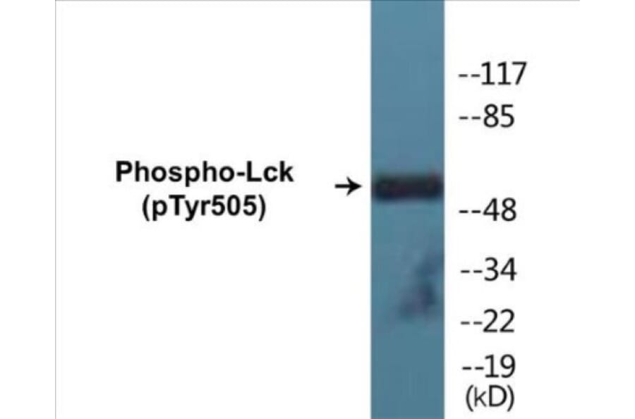 Western Blot - Lck (phospho Tyr505) Cell Based ELISA Kit (CBP1174) - Antibodies.com