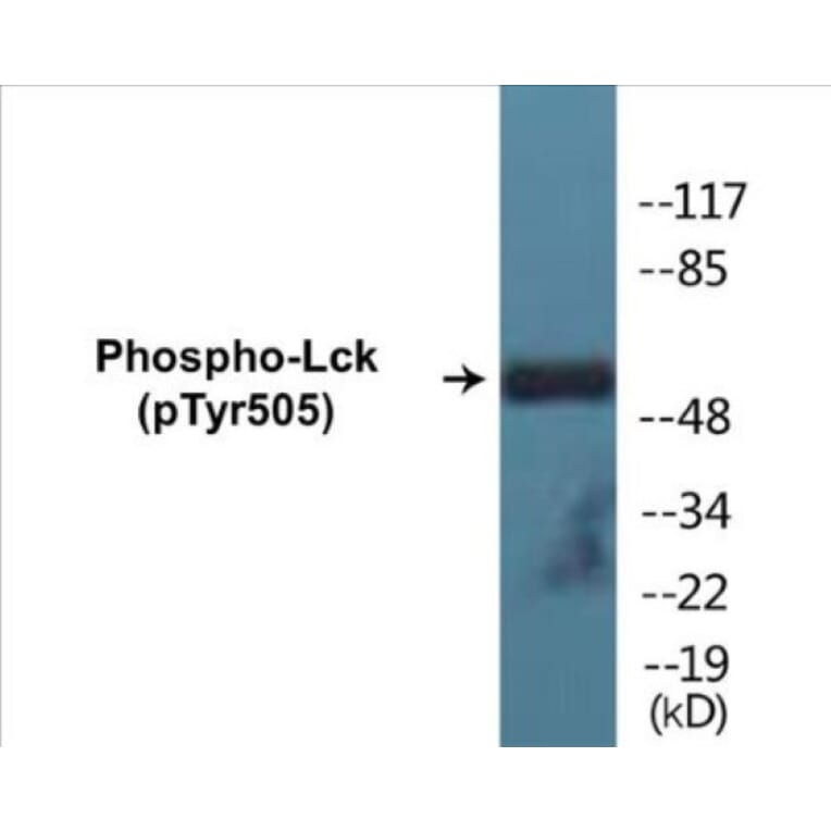 Western Blot - Lck (phospho Tyr505) Cell Based ELISA Kit (CBP1174) - Antibodies.com