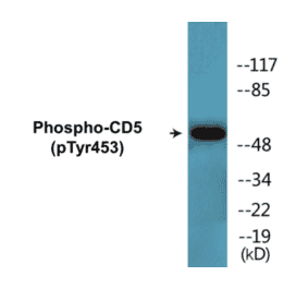 Western Blot - CD5 (phospho Tyr453) Cell Based ELISA Kit (CBP1339) - Antibodies.com