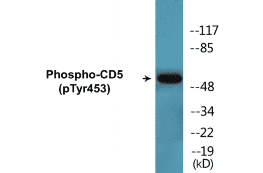 Western Blot - CD5 (phospho Tyr453) Cell Based ELISA Kit (CBP1339) - Antibodies.com