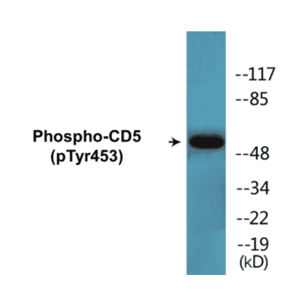 Western Blot - CD5 (phospho Tyr453) Cell Based ELISA Kit (CBP1339) - Antibodies.com