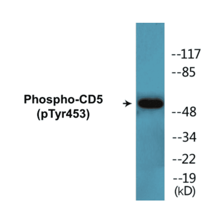 Western Blot - CD5 (phospho Tyr453) Cell Based ELISA Kit (CBP1339) - Antibodies.com