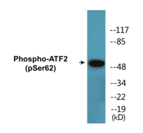 Western Blot - ATF2 (phospho Ser62) Cell Based ELISA Kit (CBP1496) - Antibodies.com