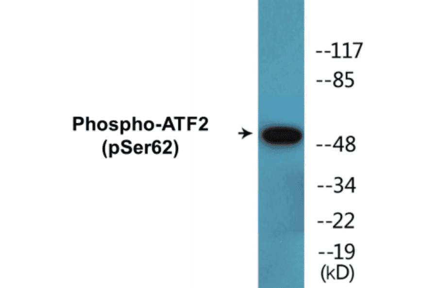 Western Blot - ATF2 (phospho Ser62) Cell Based ELISA Kit (CBP1496) - Antibodies.com