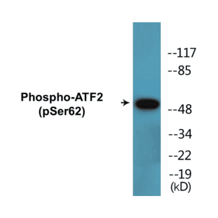 Western Blot - ATF2 (phospho Ser62) Cell Based ELISA Kit (CBP1496) - Antibodies.com