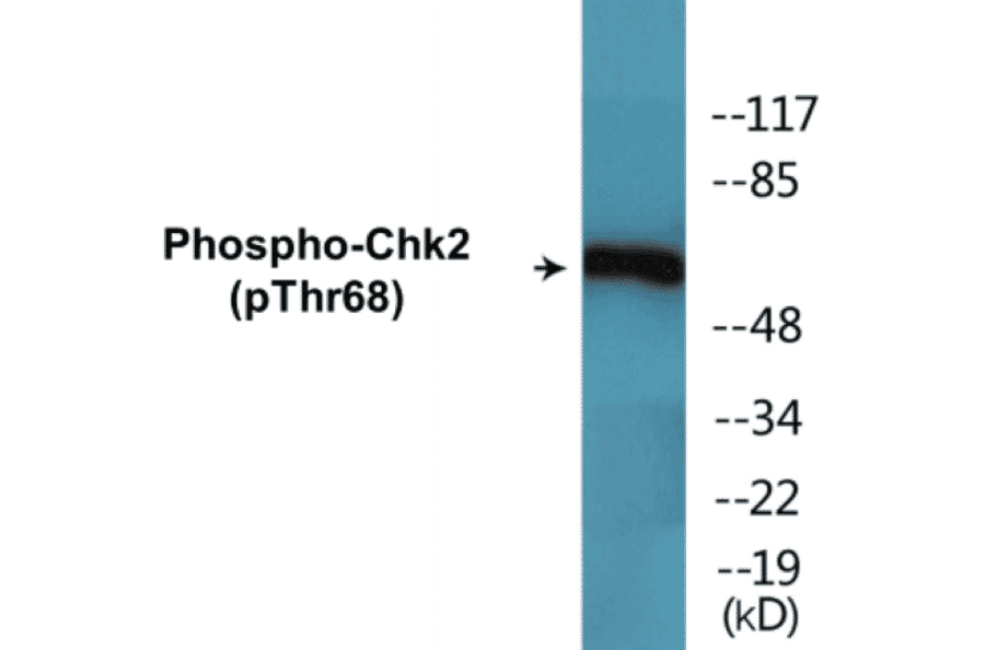 Western Blot - Chk2 (phospho Thr68) Cell Based ELISA Kit (CBP1518) - Antibodies.com
