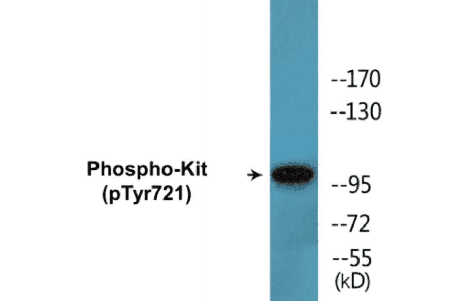 Western Blot - Kit (phospho Tyr721) Cell Based ELISA Kit (CBP1603) - Antibodies.com