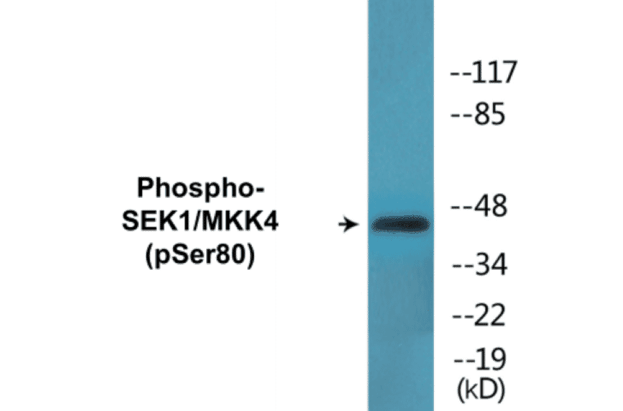 Western Blot - SEK1 (phospho Ser80) Cell Based ELISA Kit (CBP1672) - Antibodies.com