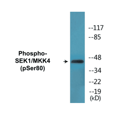 Western Blot - SEK1 (phospho Ser80) Cell Based ELISA Kit (CBP1672) - Antibodies.com