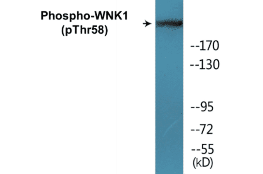 Western Blot - WNK1 (phospho Thr58) Cell Based ELISA Kit (CBP1086) - Antibodies.com