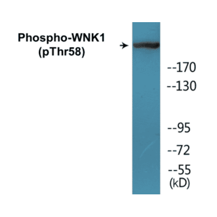 Western Blot - WNK1 (phospho Thr58) Cell Based ELISA Kit (CBP1086) - Antibodies.com