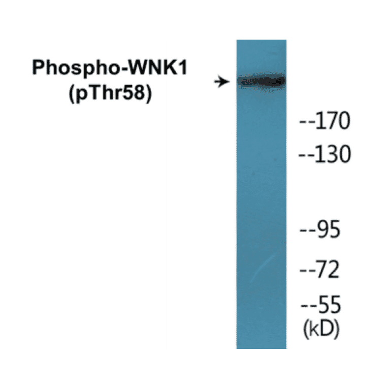 Western Blot - WNK1 (phospho Thr58) Cell Based ELISA Kit (CBP1086) - Antibodies.com
