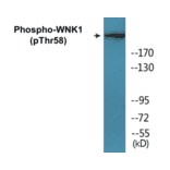 Western Blot - WNK1 (phospho Thr58) Cell Based ELISA Kit (CBP1086) - Antibodies.com