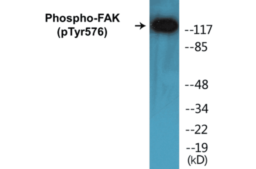 Western Blot - FAK (phospho Tyr576) Cell Based ELISA Kit (CBP1115) - Antibodies.com