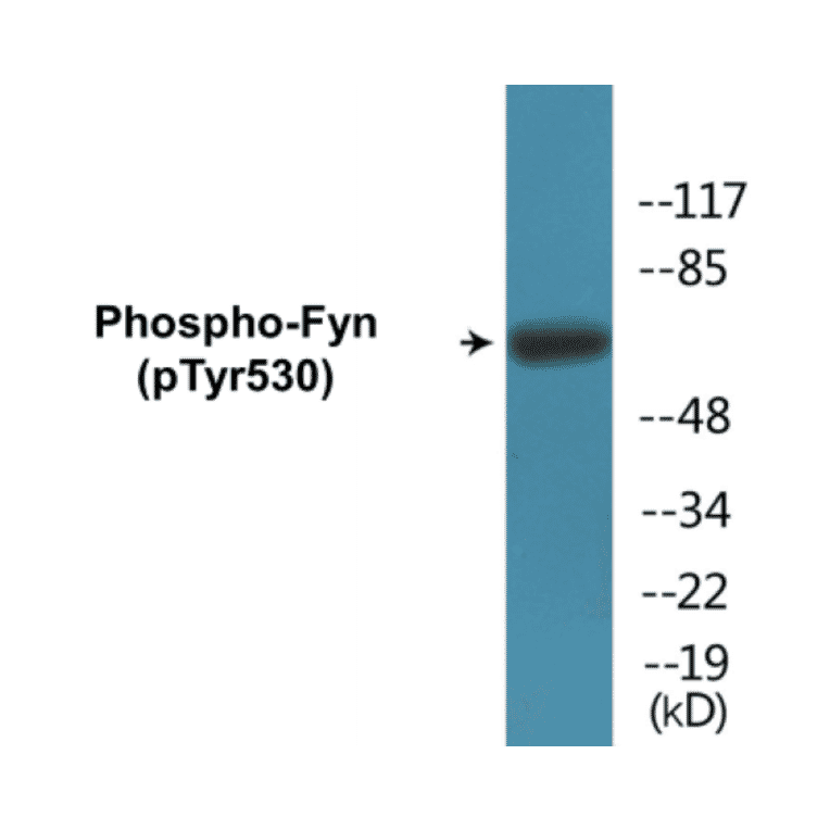 Western Blot - Fyn (phospho Tyr530) Cell Based ELISA Kit (CBP1118) - Antibodies.com