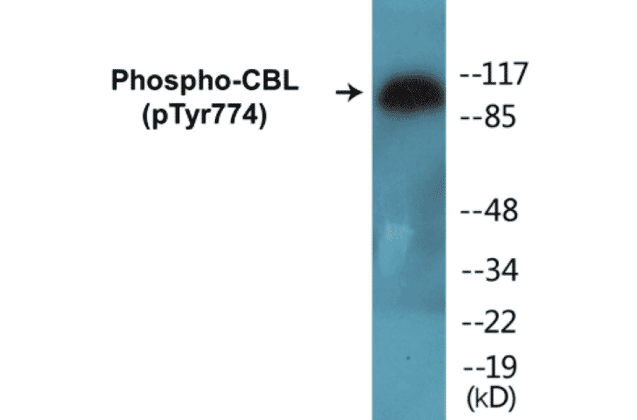 Western Blot - CBL (phospho Tyr774) Cell Based ELISA Kit (CBP1145) - Antibodies.com