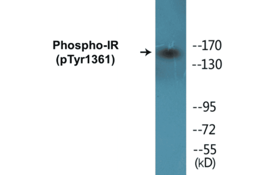 Western Blot - IR (phospho Tyr1361) Cell Based ELISA Kit (CBP1165) - Antibodies.com
