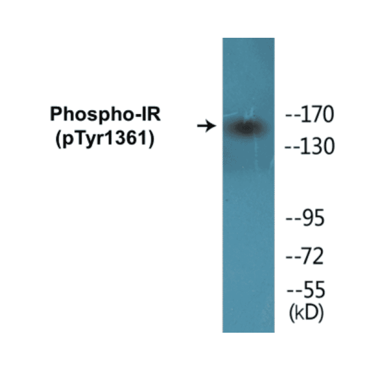 Western Blot - IR (phospho Tyr1361) Cell Based ELISA Kit (CBP1165) - Antibodies.com