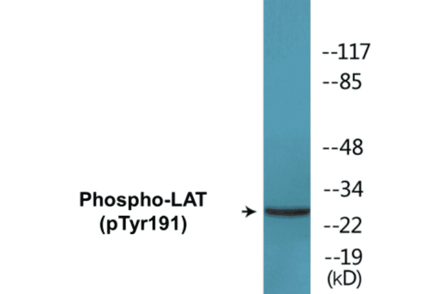 Western Blot - LAT (phospho Tyr191) Cell Based ELISA Kit (CBP1173) - Antibodies.com