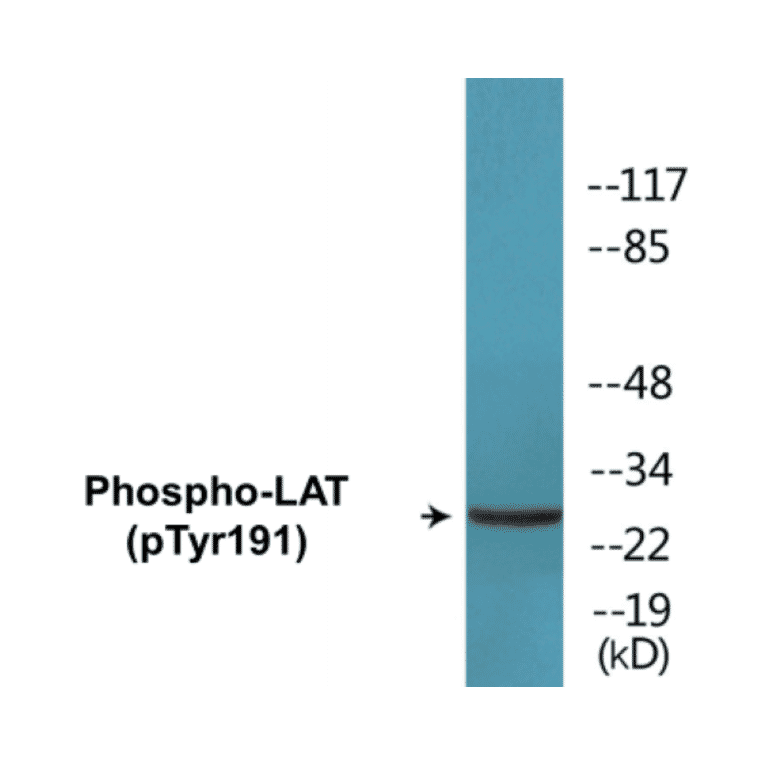 Western Blot - LAT (phospho Tyr191) Cell Based ELISA Kit (CBP1173) - Antibodies.com