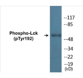 Western Blot - Lck (phospho Tyr192) Cell Based ELISA Kit (CBP1175) - Antibodies.com