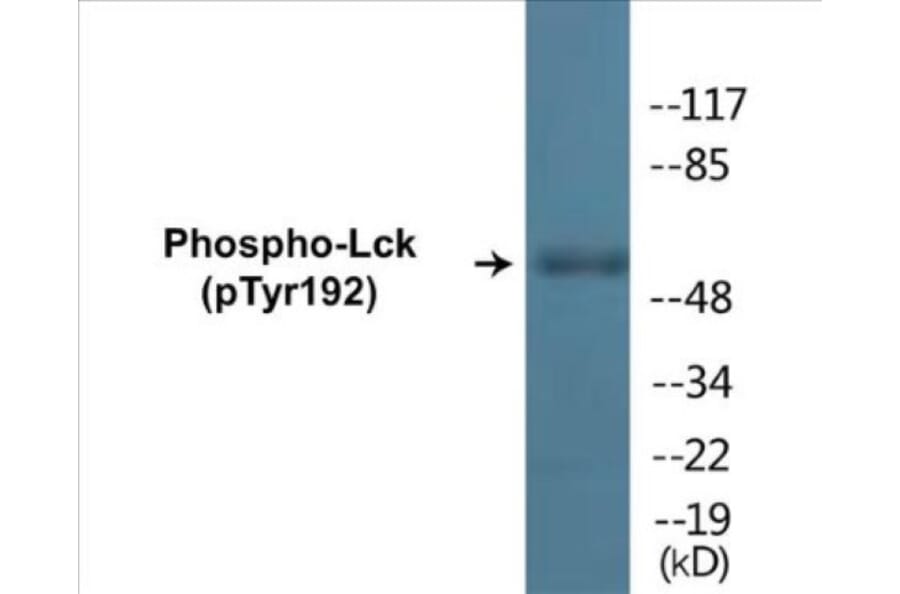 Western Blot - Lck (phospho Tyr192) Cell Based ELISA Kit (CBP1175) - Antibodies.com
