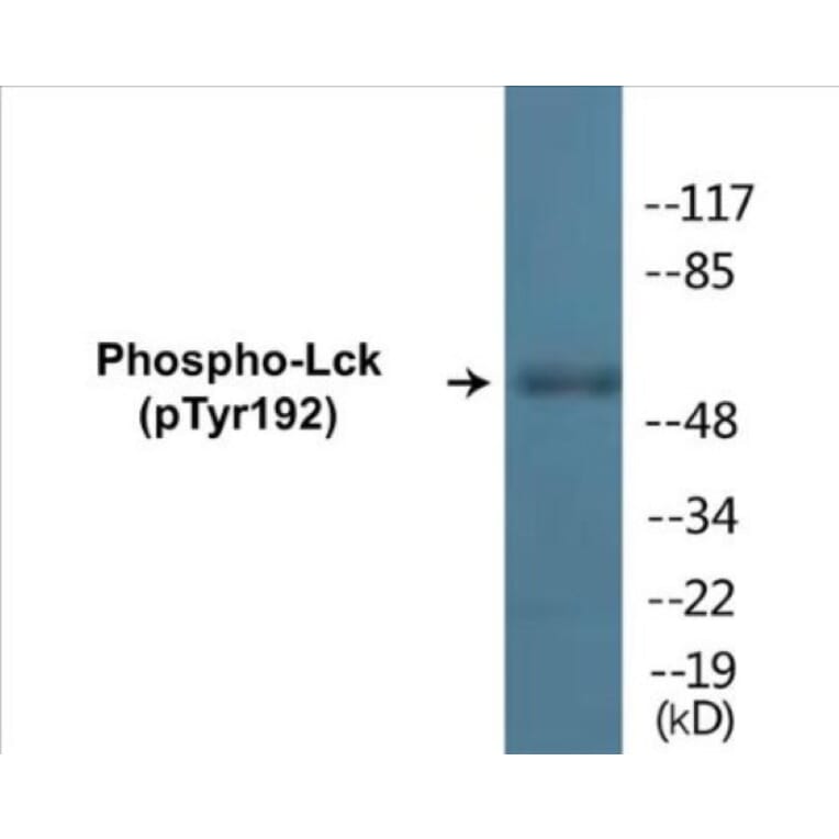 Western Blot - Lck (phospho Tyr192) Cell Based ELISA Kit (CBP1175) - Antibodies.com