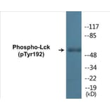 Western Blot - Lck (phospho Tyr192) Cell Based ELISA Kit (CBP1175) - Antibodies.com