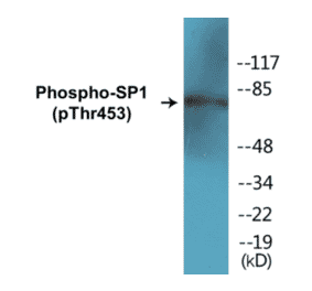 Western Blot - SP1 (phospho Thr453) Cell Based ELISA Kit (CBP1217) - Antibodies.com