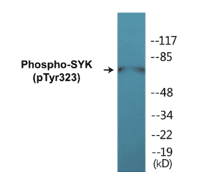 Western Blot - SYK (phospho Tyr323) Cell Based ELISA Kit (CBP1219) - Antibodies.com