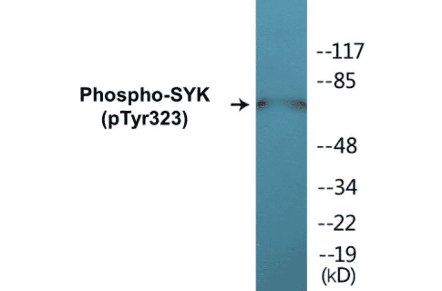 Western Blot - SYK (phospho Tyr323) Cell Based ELISA Kit (CBP1219) - Antibodies.com