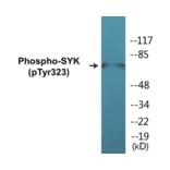 Western Blot - SYK (phospho Tyr323) Cell Based ELISA Kit (CBP1219) - Antibodies.com