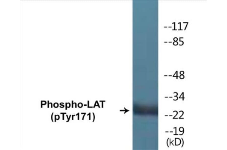Western Blot - LAT (phospho Tyr171) Cell Based ELISA Kit (CBP1254) - Antibodies.com