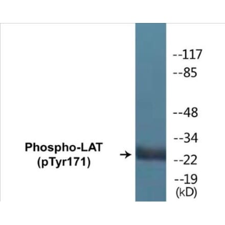 Western Blot - LAT (phospho Tyr171) Cell Based ELISA Kit (CBP1254) - Antibodies.com