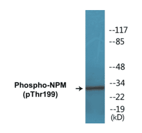 Western Blot - NPM (phospho Thr199) Cell Based ELISA Kit (CBP1265) - Antibodies.com