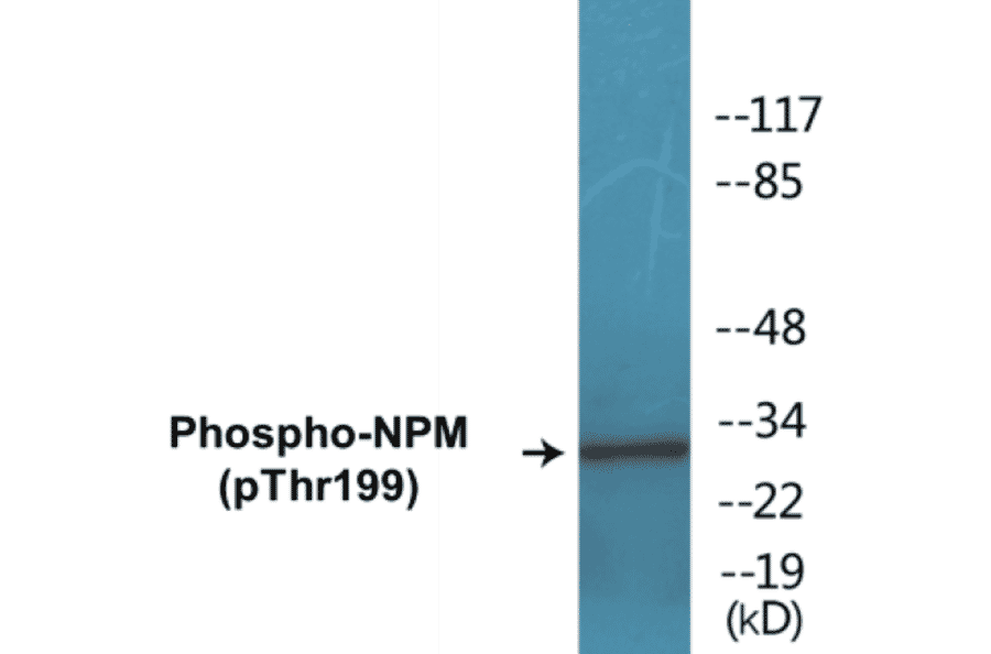 Western Blot - NPM (phospho Thr199) Cell Based ELISA Kit (CBP1265) - Antibodies.com