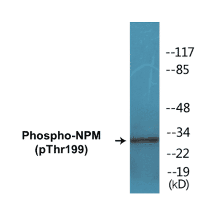 Western Blot - NPM (phospho Thr199) Cell Based ELISA Kit (CBP1265) - Antibodies.com