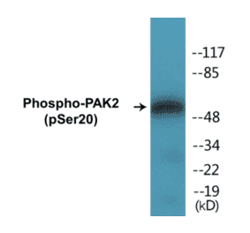 Western Blot - PAK2 (phospho Ser20) Cell Based ELISA Kit (CBP1269) - Antibodies.com