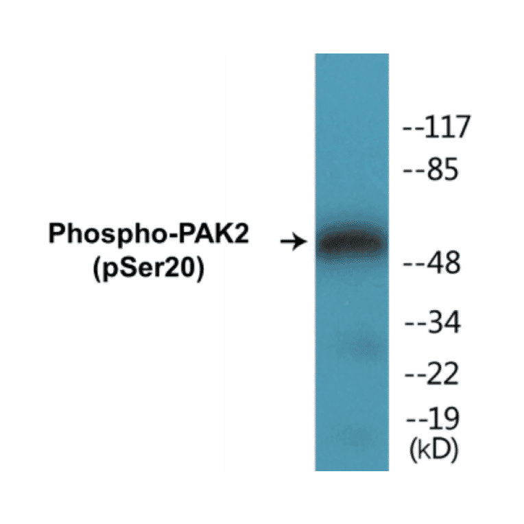 Western Blot - PAK2 (phospho Ser20) Cell Based ELISA Kit (CBP1269) - Antibodies.com