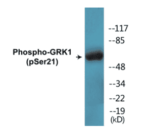 Western Blot - GRK1 (phospho Ser21) Cell Based ELISA Kit (CBP1377) - Antibodies.com