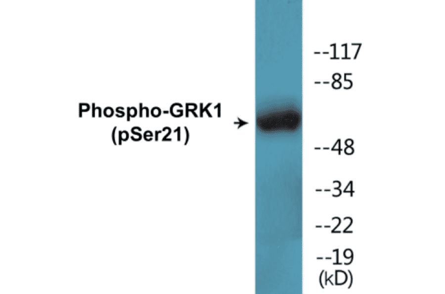 Western Blot - GRK1 (phospho Ser21) Cell Based ELISA Kit (CBP1377) - Antibodies.com