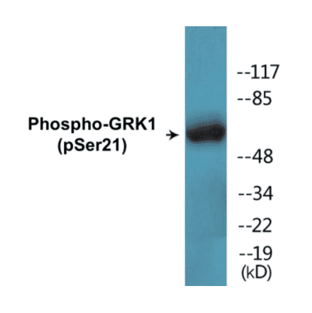 Western Blot - GRK1 (phospho Ser21) Cell Based ELISA Kit (CBP1377) - Antibodies.com