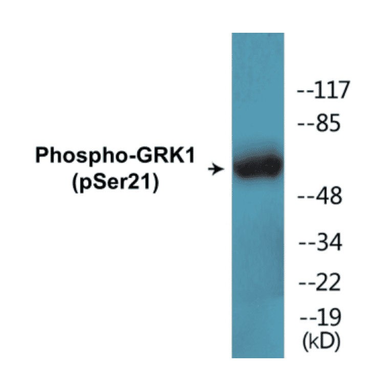 Western Blot - GRK1 (phospho Ser21) Cell Based ELISA Kit (CBP1377) - Antibodies.com